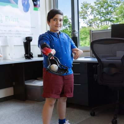 A young boy plays with a ball using his lacrosse prosthetic