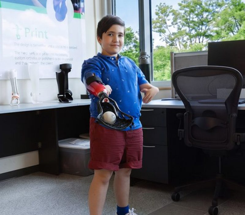 A young boy plays with a ball using his lacrosse prosthetic